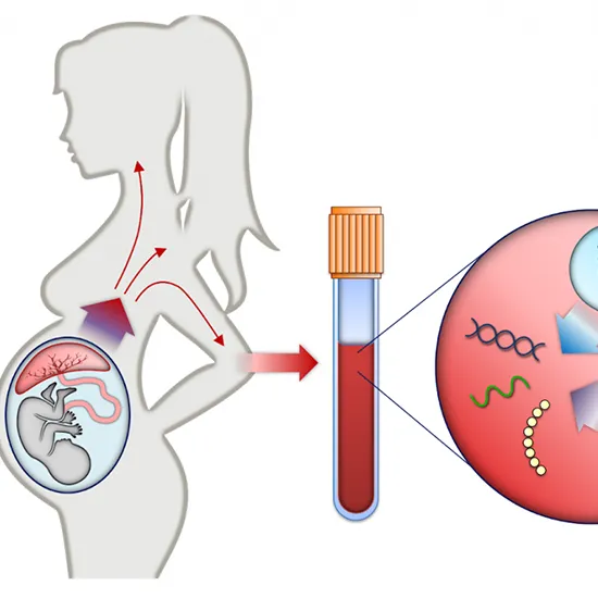 nipt: maternal blood for fetal dna (mbfd)